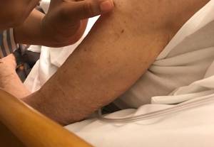 Vaccinatie Oudshoorn (1)